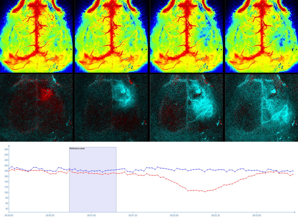 Monitoreo del cerebro del ratón usando PSI HR - Supervisión del Flujo Sanguíneo Cerebral